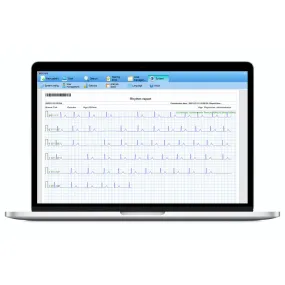 ECG Management System